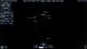 01-firstMoonAssist.jpg